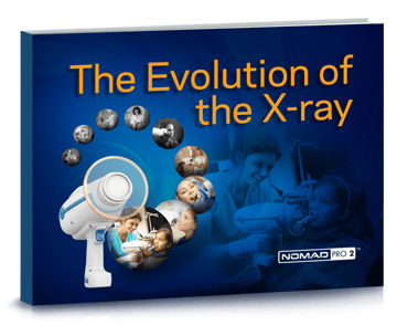 The Evolution of the X-ray